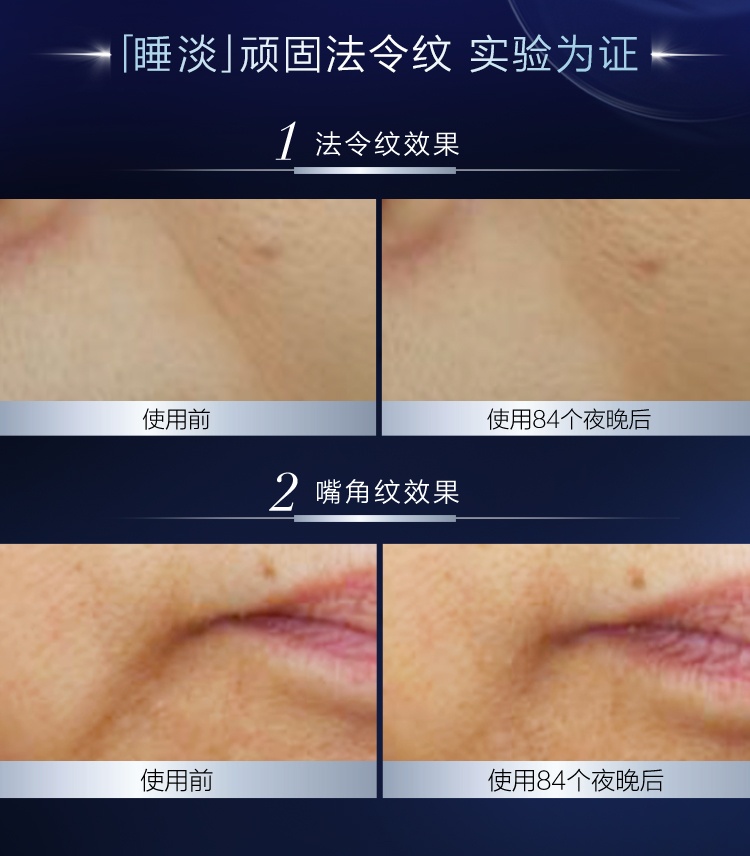 商品L'Oreal Paris|L'oreal 欧莱雅 A醇精华复颜精纯视黄醇夜精华露 30ml 补水保湿淡化细纹,价格¥317,第8张图片详细描述