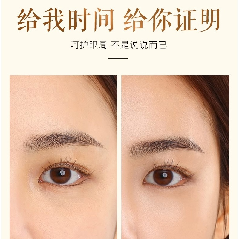 商品[国内直发] URARA|悠莱生机明眸金致紧塑眼霜 15g,价�格¥377,第6张图片详细描述