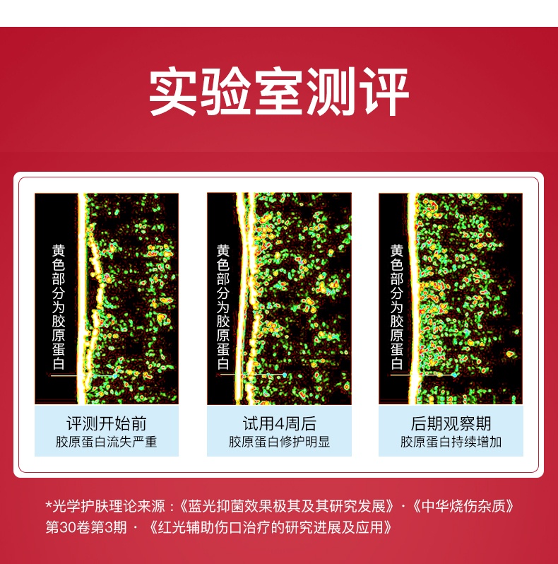 商品[国内直发] GLENVINTEN|格岚云顿goodwind射频美容仪器家用脸部提亮肤色提拉紧致淡化法令纹,价格¥558,第3张图片详细描述