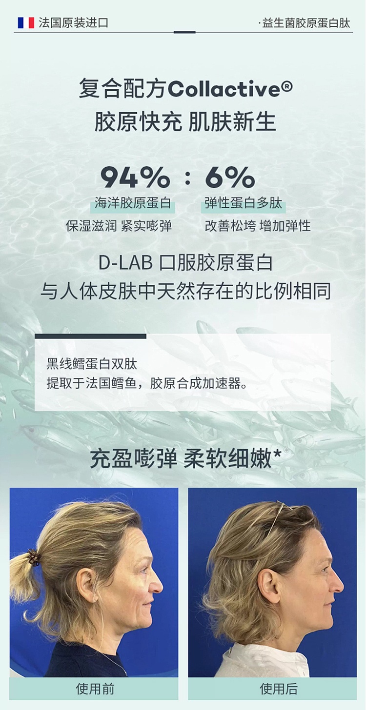 商品D-Lab|D-Lab胶原蛋白粉益生菌pro椰子味 194g 改善肠道皮肤嘭弹透亮,价格¥580,第6张图片详细描述