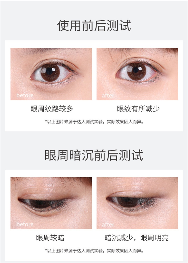 商品Annemarie Borlind|安娜柏林小白管抗皱眼霜20ml,价格¥210,第15张图片详细描述