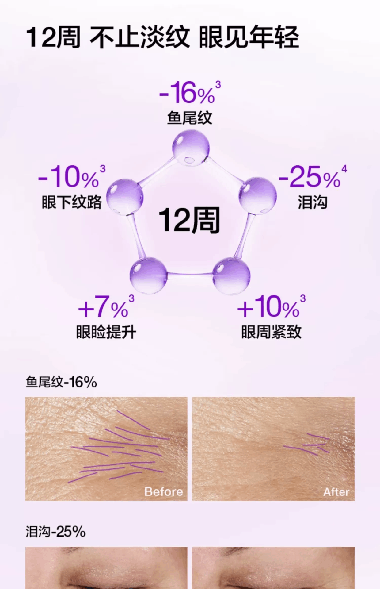 商品Clinique|美国CLINIQUE倩碧 智慧专研抚纹眼霜 1870紫光瓶精华眼霜15ml,价格¥354,第5张图片详细描述