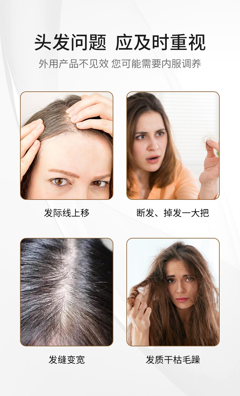 商品[国内直发] Biowell|【护发神器】护发咀嚼片改善毛躁分叉滋养柔顺搭配护发精油盈密秀发强韧发根 60粒/瓶,价格¥282,第3张图片详细描述