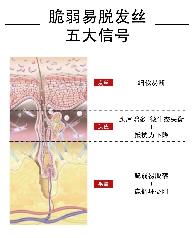 商品Vichy|薇姿 DERCOS DS洗发水,价格¥142,第5张图片详细描述