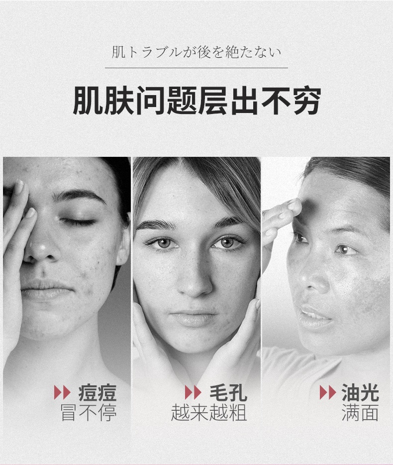 商品Shiseido|资生堂 洗颜专科洗面奶 珊珂泡沫洁面乳 深层清洁 控油保湿125ml,价格¥72,第3张图片详细描述