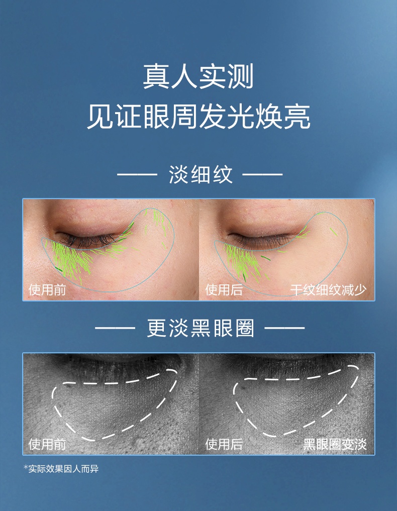 商品Lancôme|兰蔻 发光眼霜 小黑瓶眼霜 熬夜淡纹淡黑眼圈修护眼 15ml ,价格¥216,第4张图片详细描述