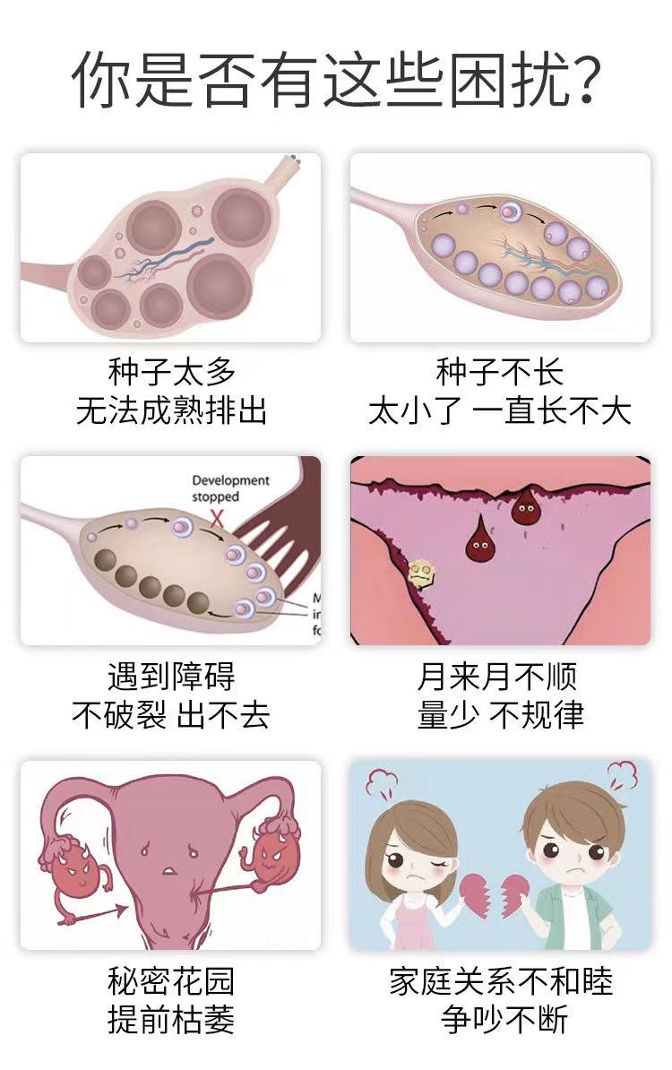 商品[国内直发] Fairhaven Health|FAIRHAVEN HEALTH  维卵康 120粒装,价格¥812,第5张图片详细描述