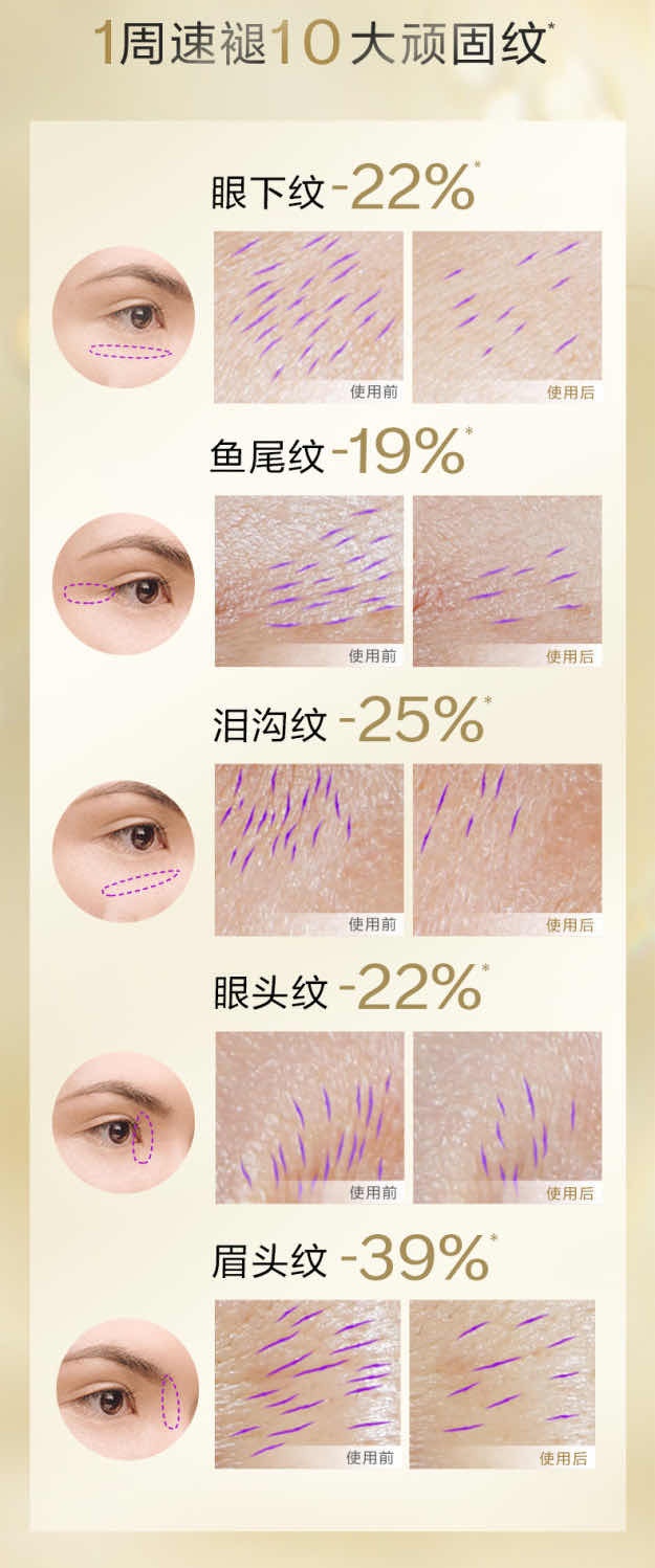 商品[国内直发] Shiseido|SHISEIDO 资生堂 悦薇智感塑颜抗皱霜 纯A小针管 眼霜20ml,价格¥510,第4张图片详细描述