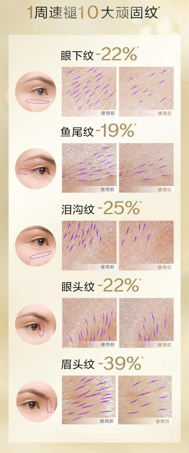 商品[国内直发] Shiseido|SHISEIDO 资生堂 悦薇智感塑颜抗皱霜 纯A小针管 眼霜20ml,价格¥510,第4张图片详细描述