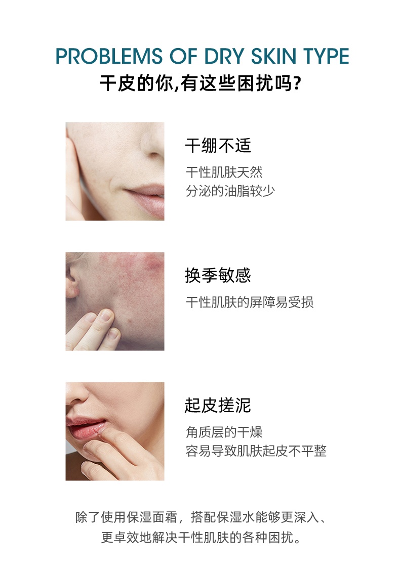 商品Kiehl's|科颜氏 金盏花保湿套装 金盏花洁面+水+高保湿水 深层清洁 强韧肌肤 维稳保湿,价格¥675,第3张图片详细描述