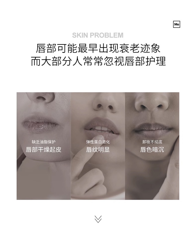 商品Mesoestetic|Mesoestetic美斯蒂克 age element唇部淡纹精华15ml 淡化唇纹滋润保湿抚纹,价格¥372,第3张图片详细描述