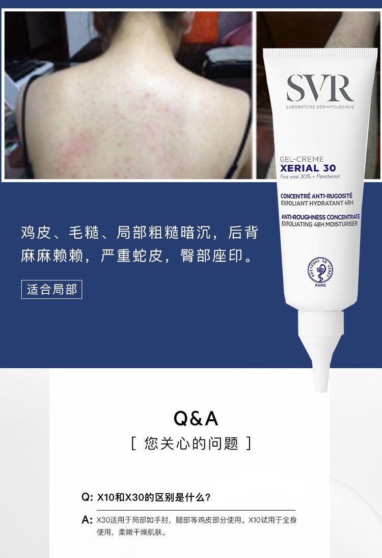 商品SVR Laboratoires|SVR舒唯雅X30 鸡皮去角质凝霜75ml,价格¥134,第7张图片详细��描述