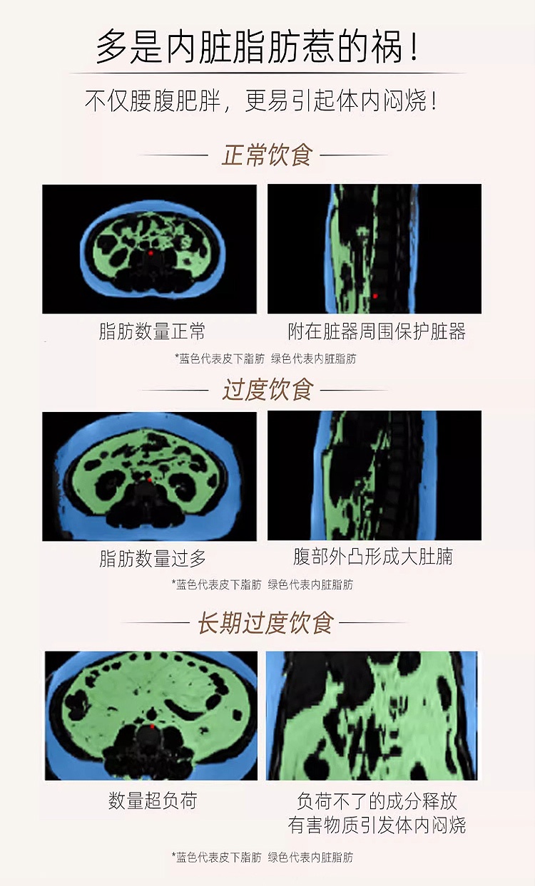 商品EAFIT|小腹婆五酶合一绿原酸咖啡提取物胶囊 120粒 减腹静燃阻糖碳油,价格¥207,第11张图片详细描述