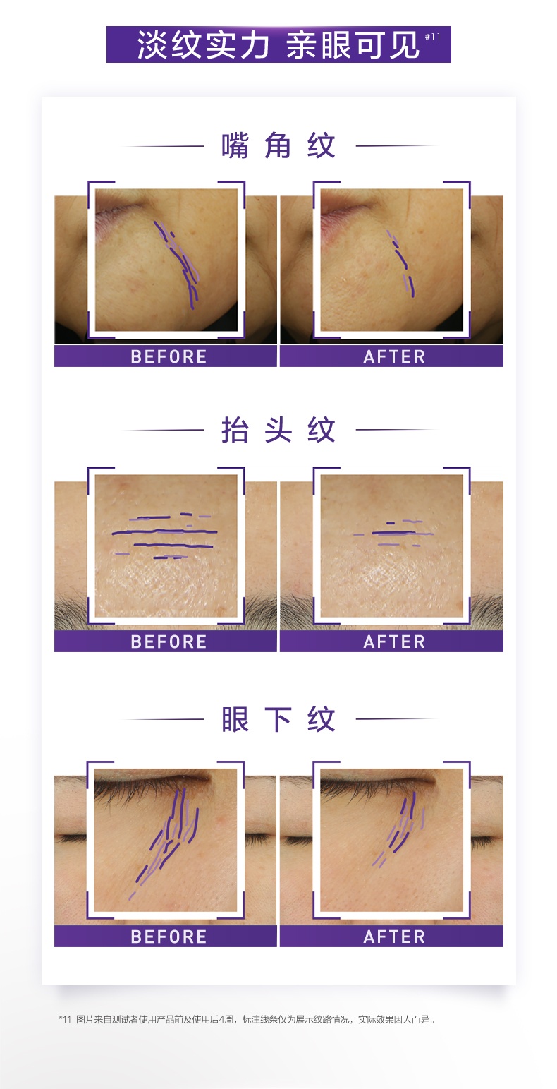 商品L'Oreal Paris|【保税仓】欧莱雅紫熨斗眼霜30ml玻色因补水保湿抗皱紧致淡化细纹护肤品,价格¥202,第4张图片详细描述