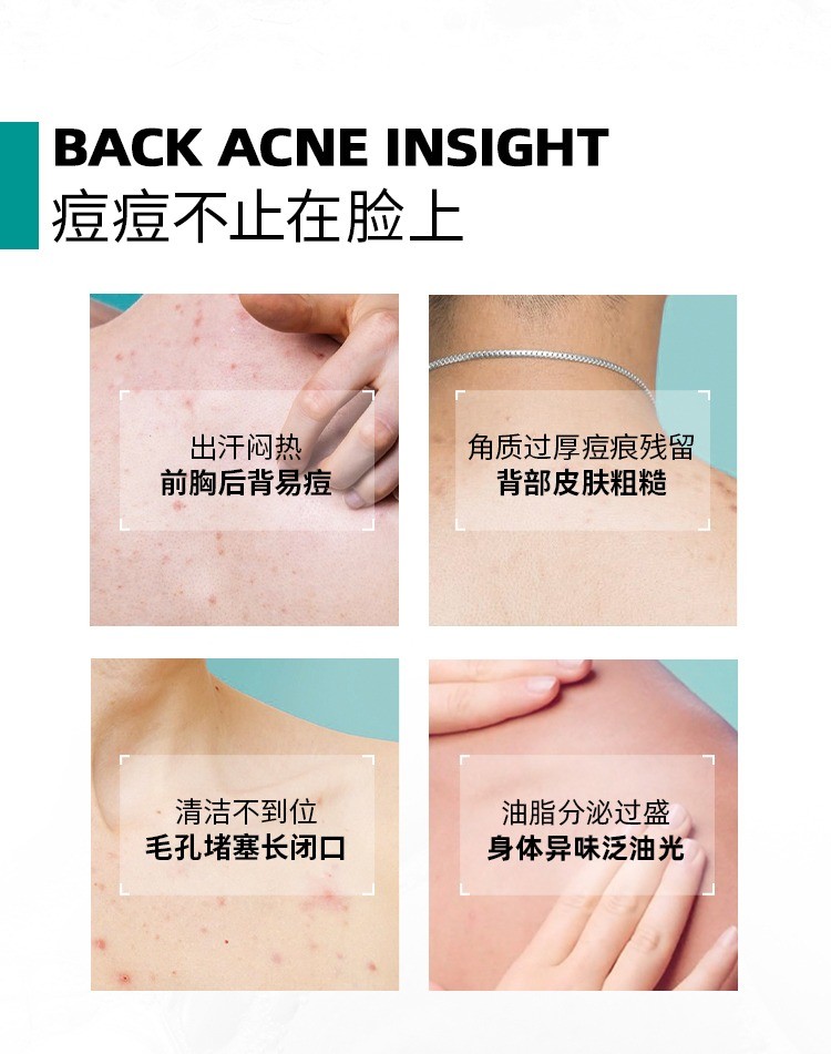 商品La Roche Posay|理肤泉 La roche posay理肤泉 2021新品水杨酸清痘沐浴露400ml,价格¥192,第3张图片详细描述