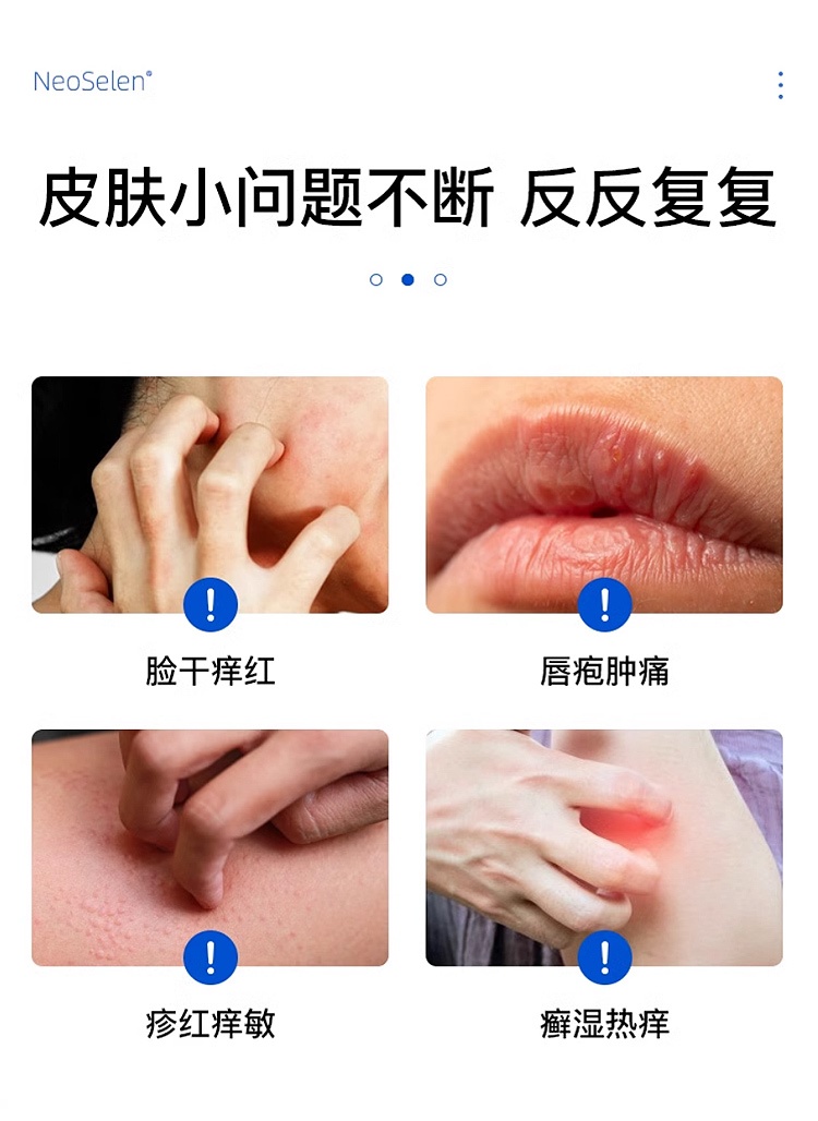 商品Bio Recherche|碧露研修护皮肤屏障过敏胶囊 90粒 胶原免疫保护,价格¥271,第8张图片详细描述