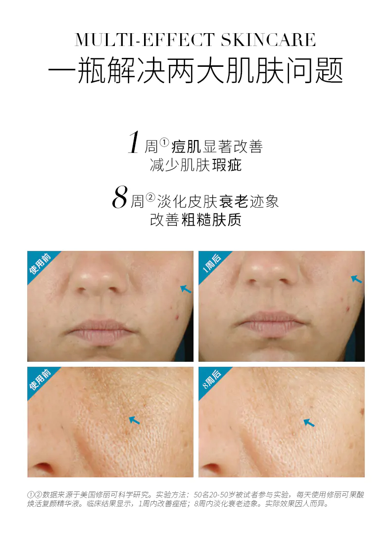 商品SkinCeuticals|修丽可果酸焕活复颜精华液30ml祛痘祛粉刺改善细纹,价格¥469,第3张图片详细描述