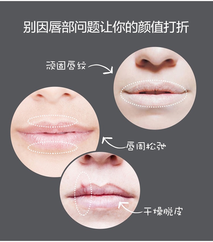 商品Uriage|Uriage依泉柔润润唇膏4gx2 小白管实力淡唇纹,价格¥140,第4张图片详细描述