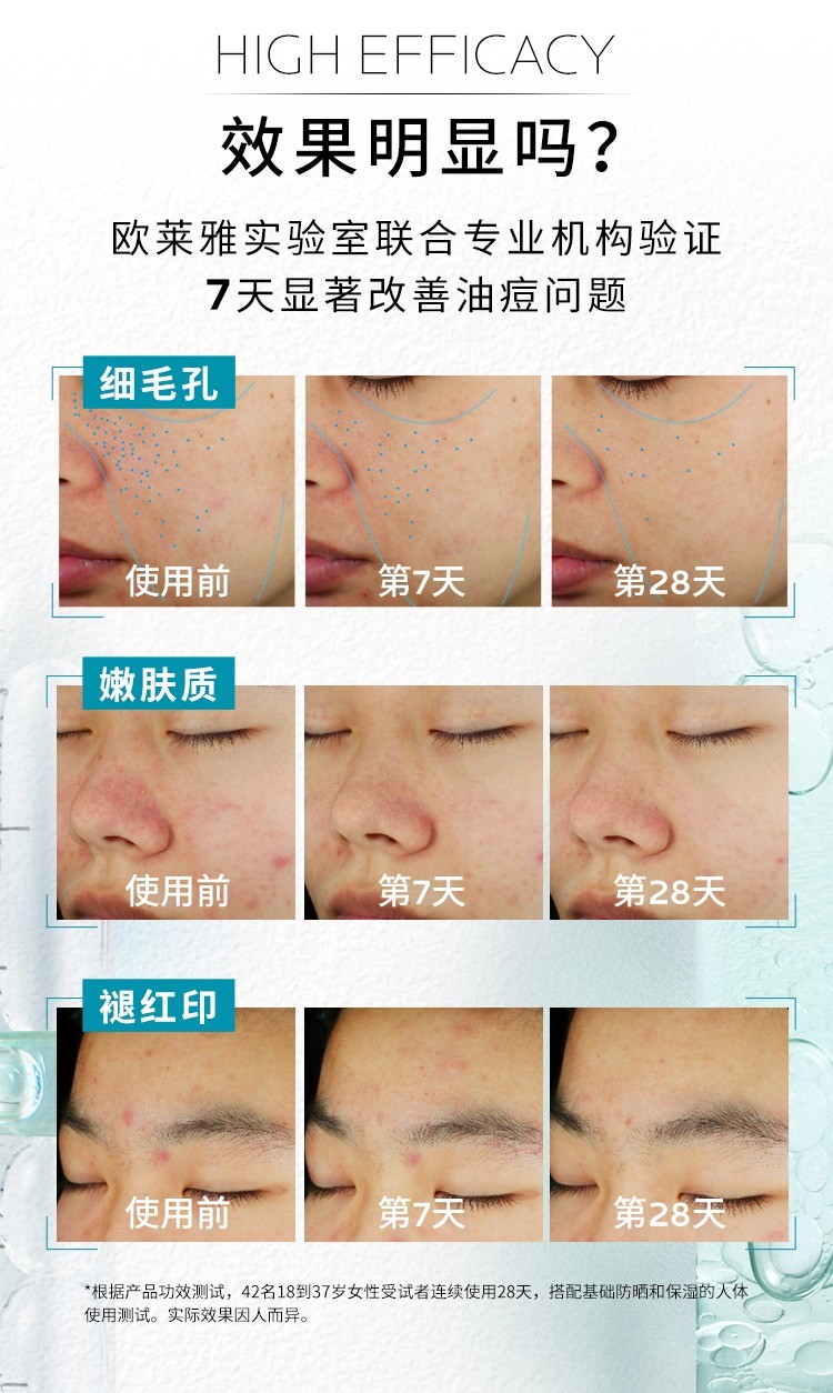 商品La Roche Posay|Laroche Posay理肤泉三酸精华30ml 淡化痘印 平滑痘痘闭口,价格¥254,第4张图片详细描述