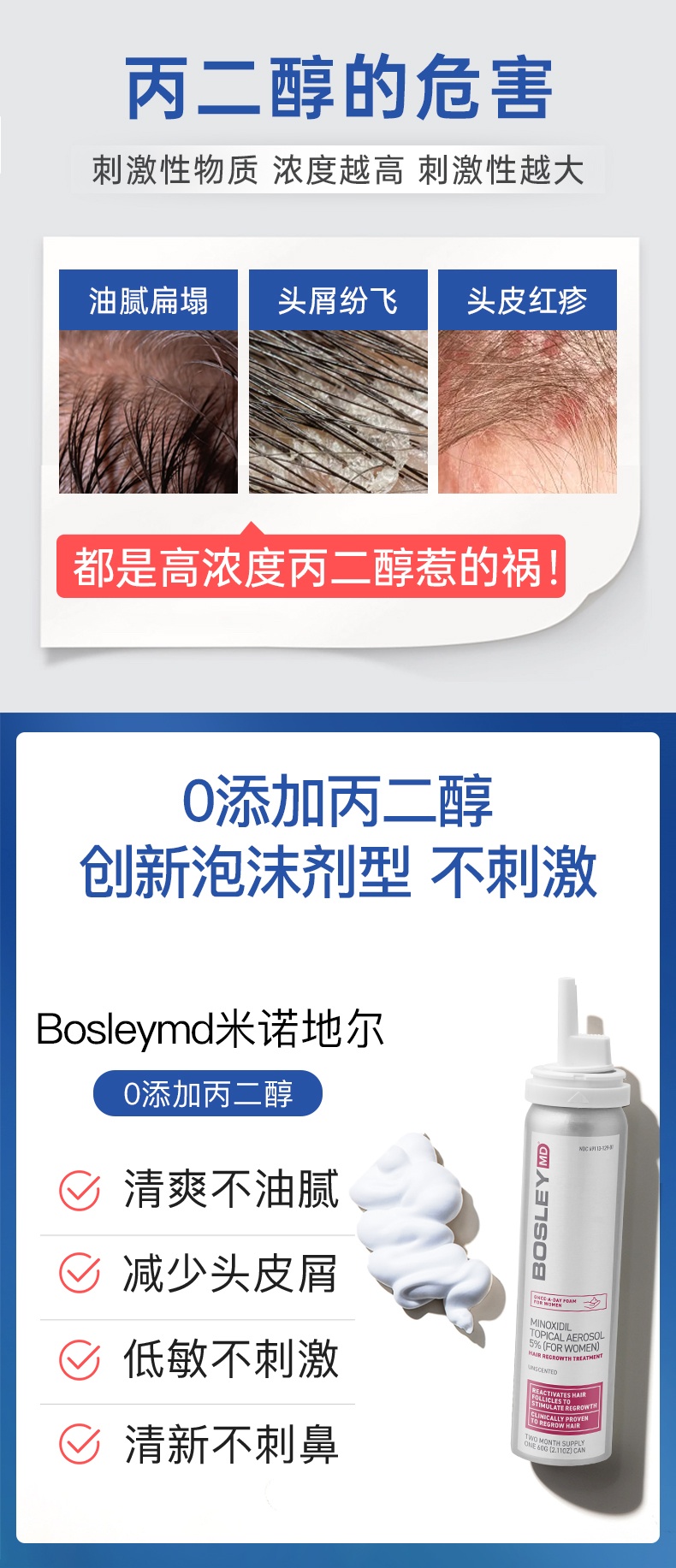 商品Rogaine|BOSLEY米诺地尔酊生发液喷雾滴剂2%斑秃防脱女生增发育发液长发剂,价格¥242,第5张图片详细描述