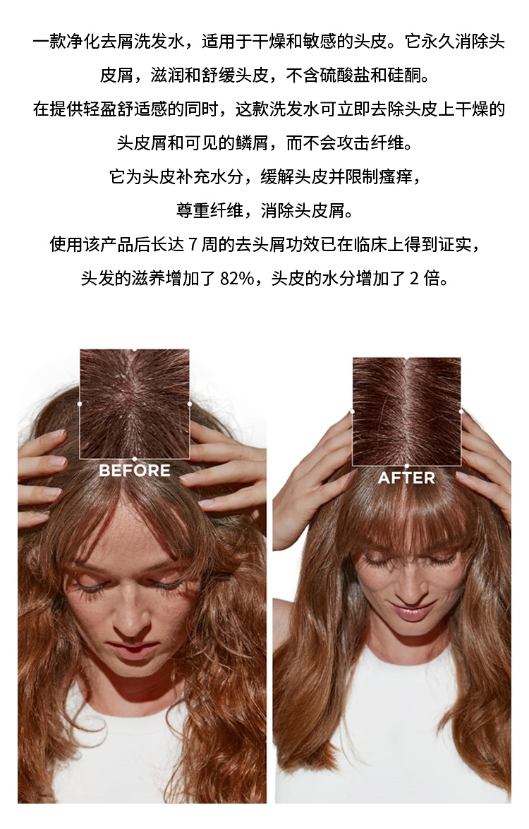 商品Kérastase|卡诗SYMBIOSE自在系列滋润去头皮屑洗发水 250ml-500ml,价格¥246,第2张图片详细描述