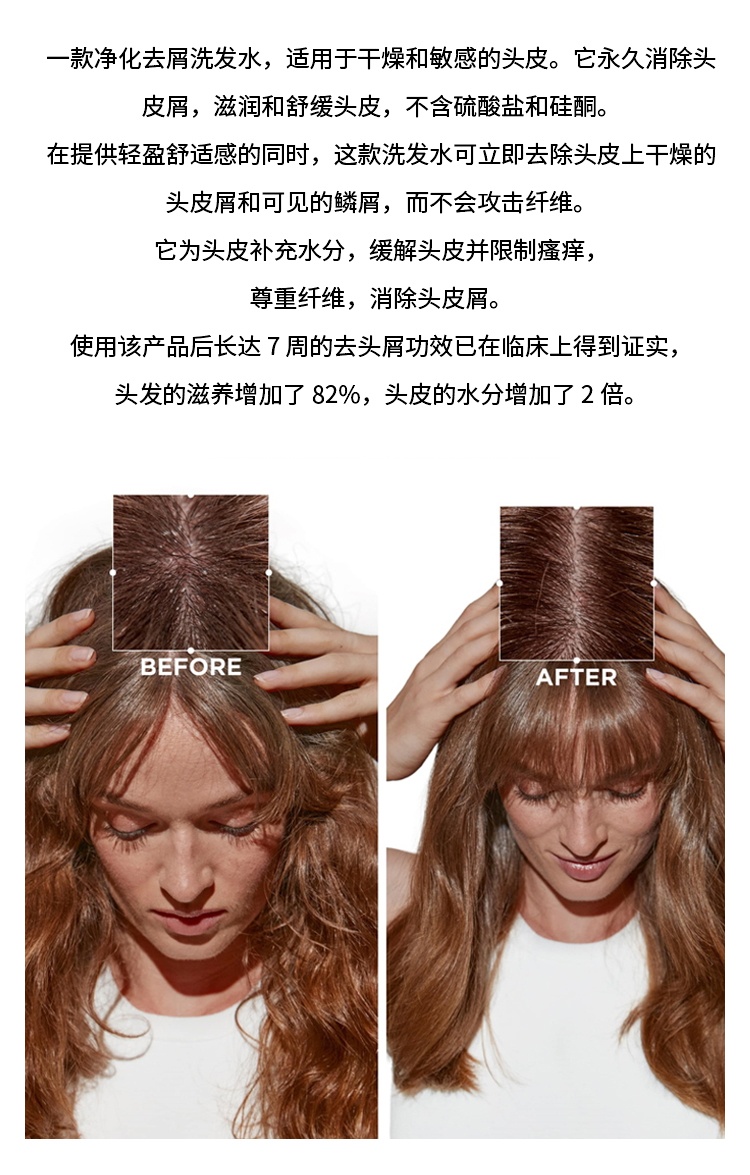 商品Kérastase|卡诗SYMBIOSE自在系列滋润去头皮屑洗发水 250ml,价格¥244,第2张图片详细描述