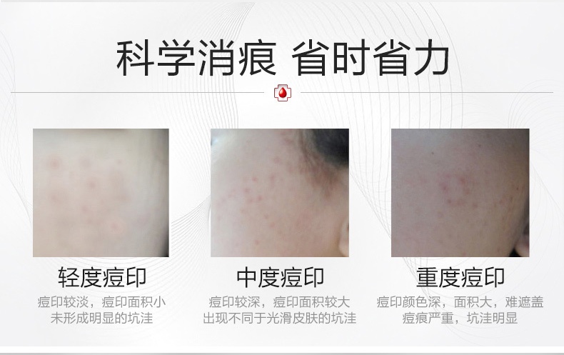 商品Winona|薇诺娜净痘清颜霜50g 淡化痘印痘痘敏感肌肤祛痘舒缓,价格¥222,第6张图片详细描述