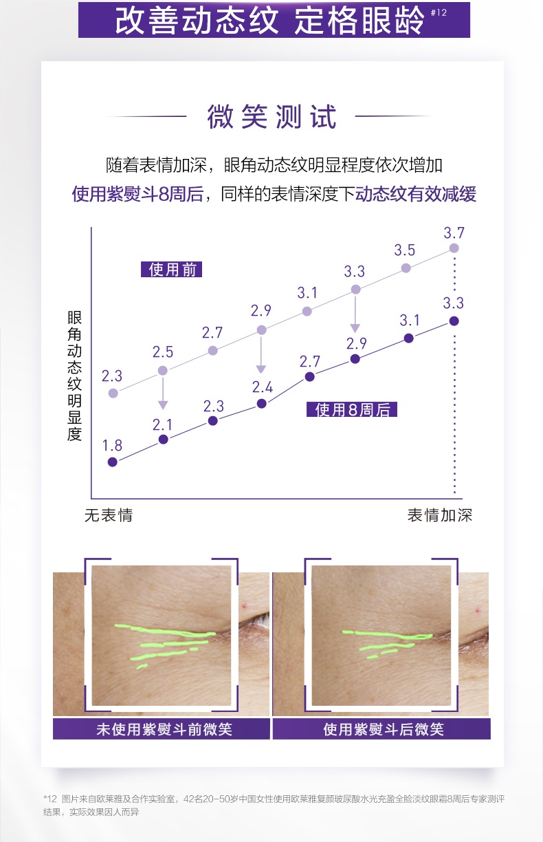 商品L'Oreal Paris|【保税仓】欧莱雅紫熨斗眼霜30ml玻色因补水保湿抗皱紧致淡化细纹护肤品,价格¥202,第5张图片详细描述