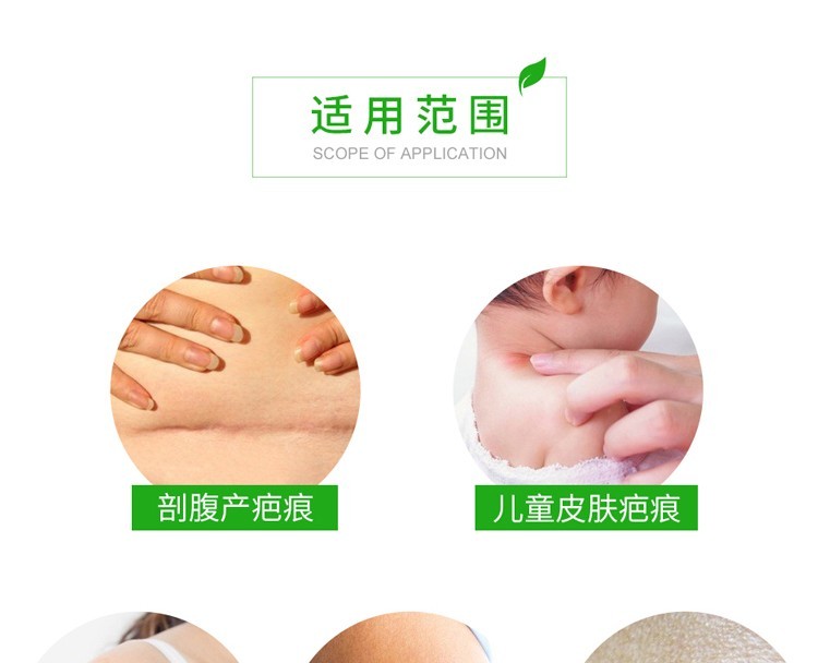 商品Mepiform|瑞典进口美皮护Mepiform增生硅凝胶祛疤贴5*7.5cm,价格¥124,第8张图片详细描述