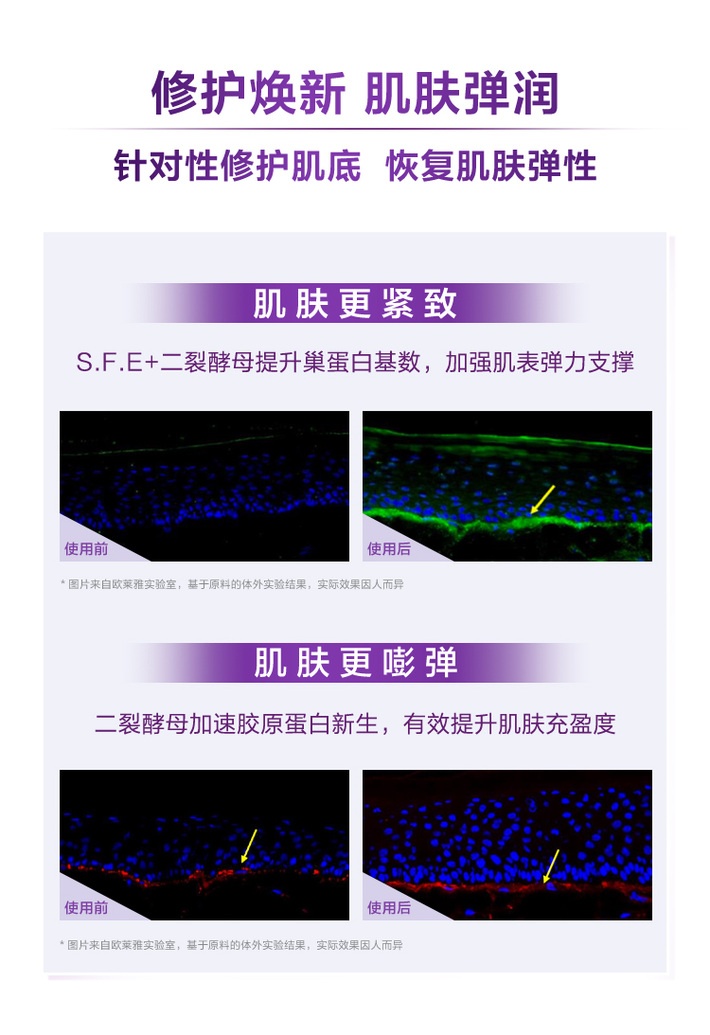 商品L'Oreal Paris|欧莱雅 青春密码酵素小黑瓶精华2件套 肌底液30ml+眼部精华20ml 维稳修护肌底 嫩肤��抗初老,价格¥365,第5张图片详细描述