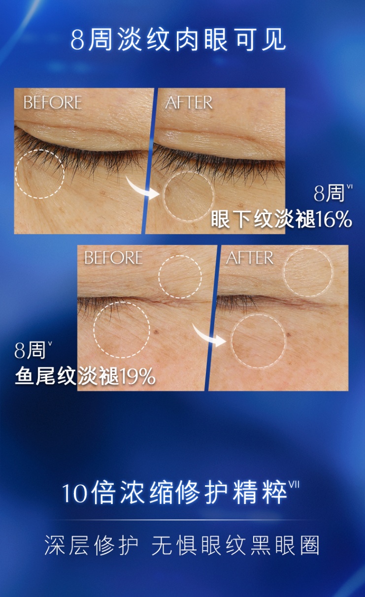 商品Estée Lauder|雅诗兰黛 七代小棕瓶抗蓝光眼霜 15ml（香港直邮版本随机发）,价格¥458,第4张图片详细描述