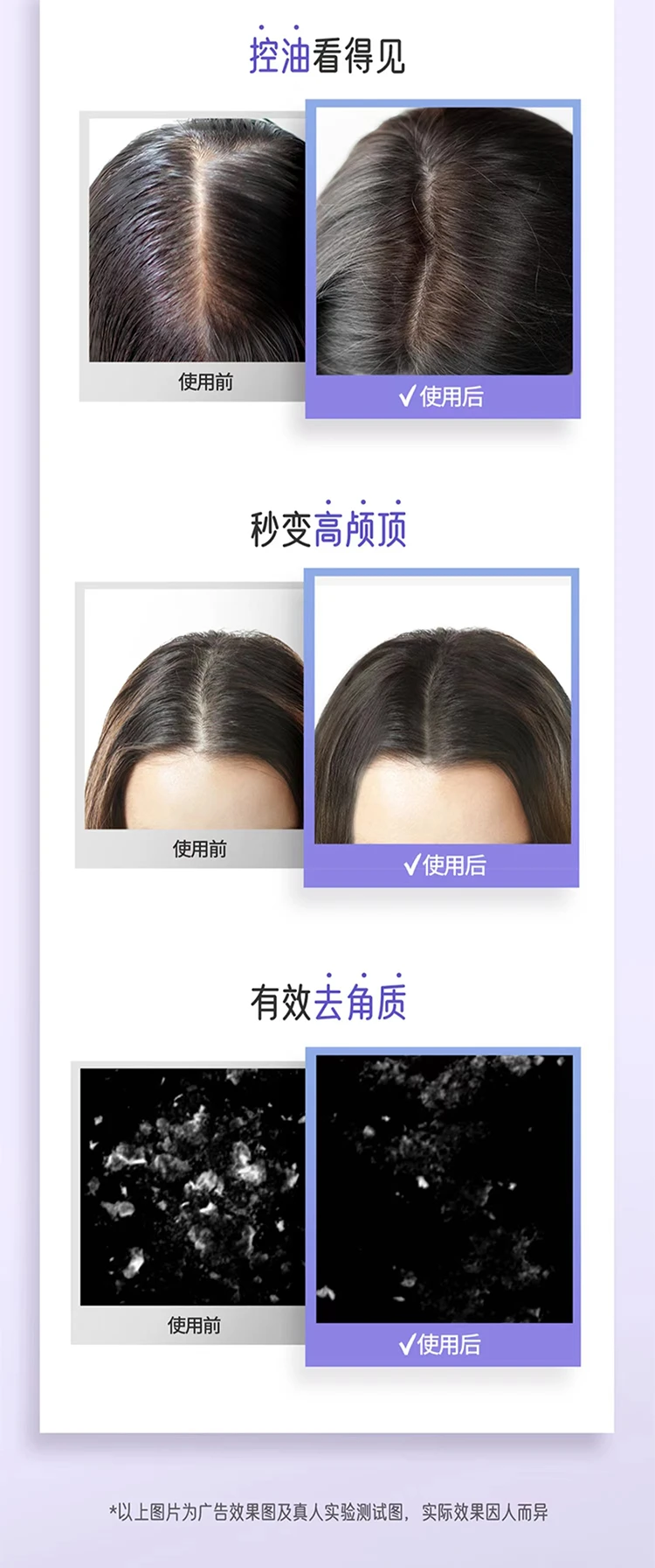 商品[国内直发] AEKYUNG KeraSys|爱敬科娜洗丝净澈奢华香氛洗发水海风鼠尾草180ml,价格¥31,第6张图片详细描述