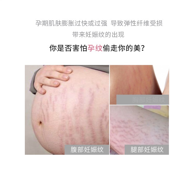商品Lierac|LIERAC丽蕾克预防妊娠纹凝胶200ml,价格¥181,第6张图片详细描述