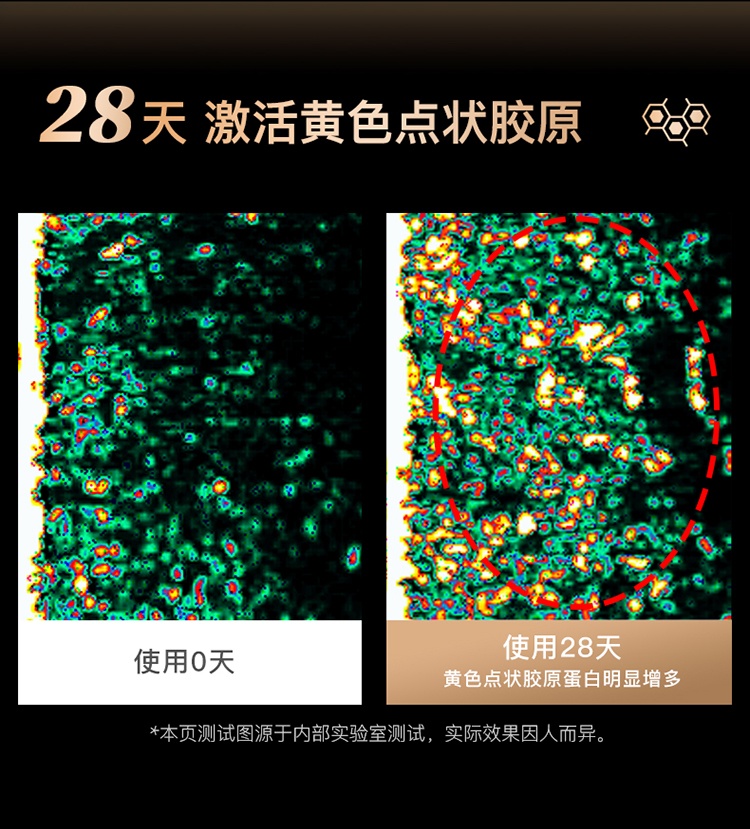 商品YA-MAN|【国行正品 国内直发】雅萌YAMANACE五代黄金五环射频美容仪S16 强效提拉淡化细纹,价格¥5350,第12张图片详细描述