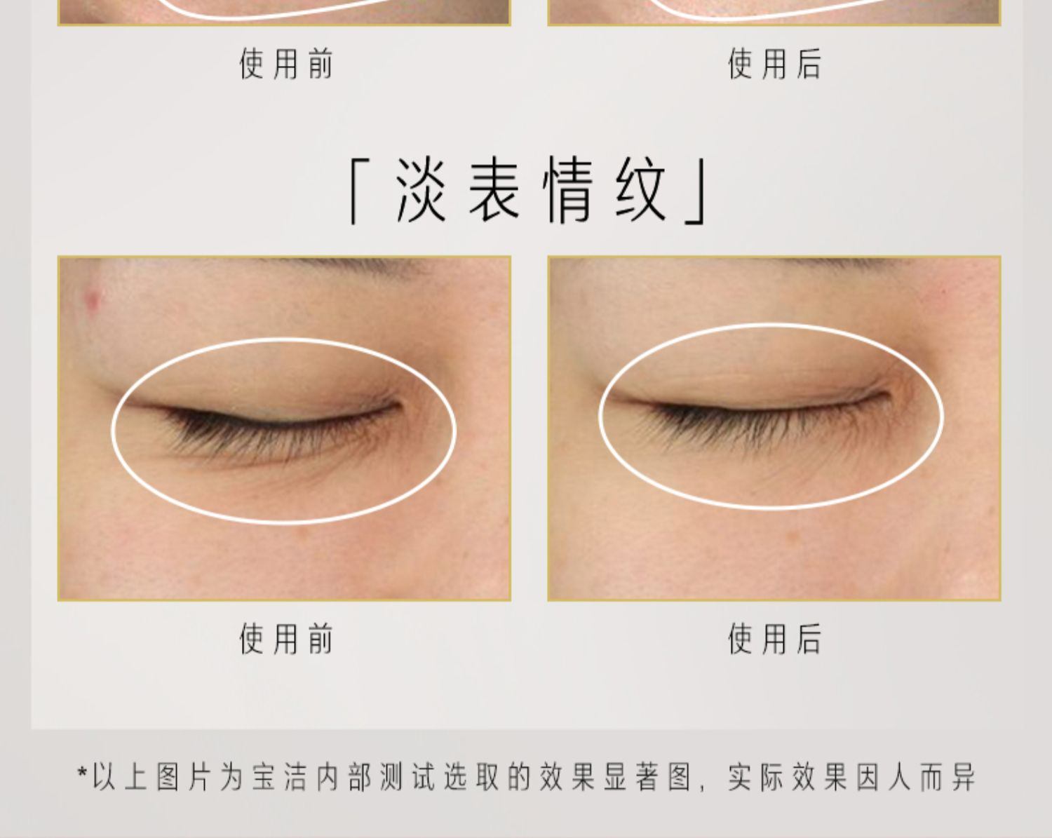 商品Olay|OLAY 玉兰油 塑颜臻粹奢护眼霜超红瓶眼霜 15g 胜肽抗皱淡化��细纹,价格¥317,第7张图片详细描述