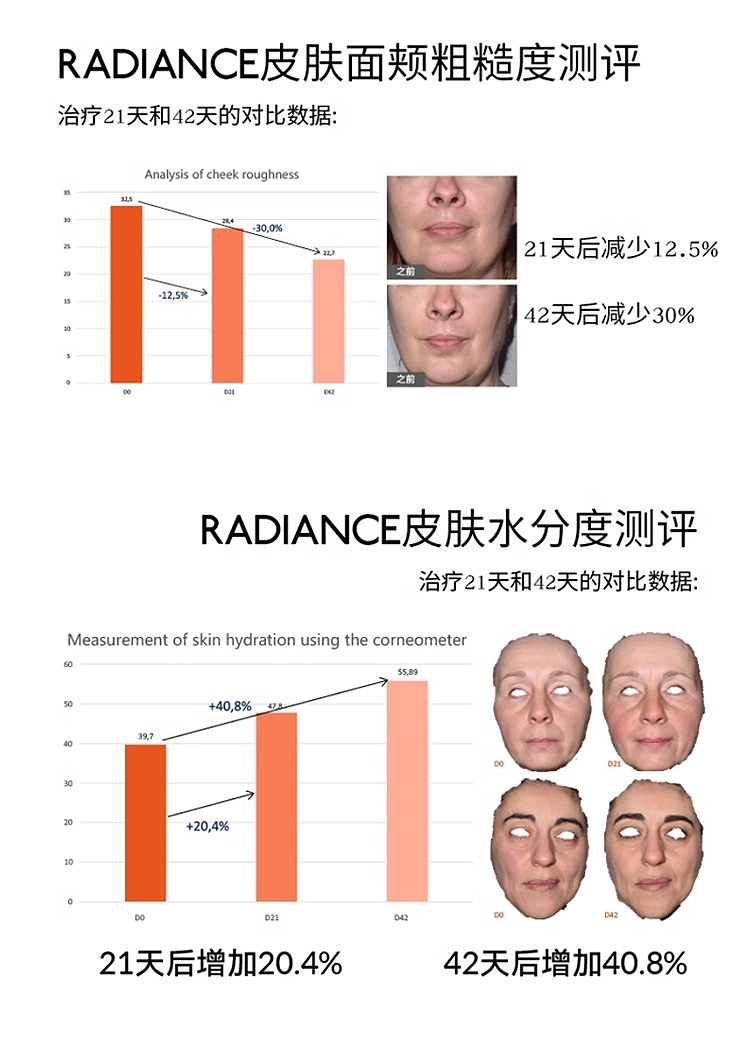 商品Evoleum|Evoleum郁梵黎玻尿酸原液焕亮小e针 21x15mL 深层补水焕亮,价格¥520,第5张图片详细描述