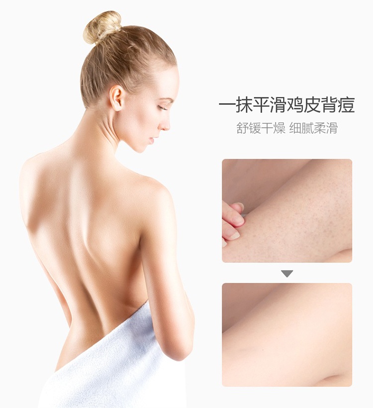 商品ENEOMEY|Eneomey果酸小灯管身体乳150ml 果酸浓度15%,价格¥414,第4张图片详细描述