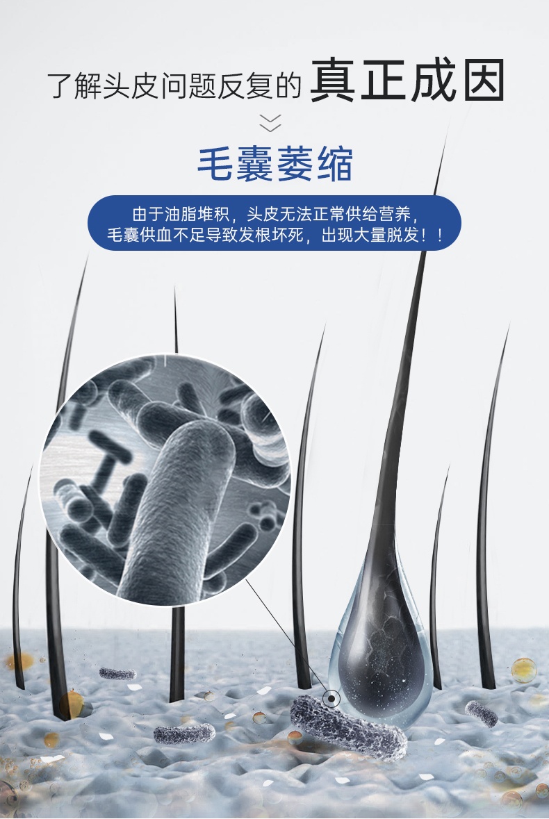 商品Rogaine|BOSLEY生发液米诺地尔酊5%男生喷雾剂增发密发防脱育发液长发剂,价格¥238,第4张图片详细描述