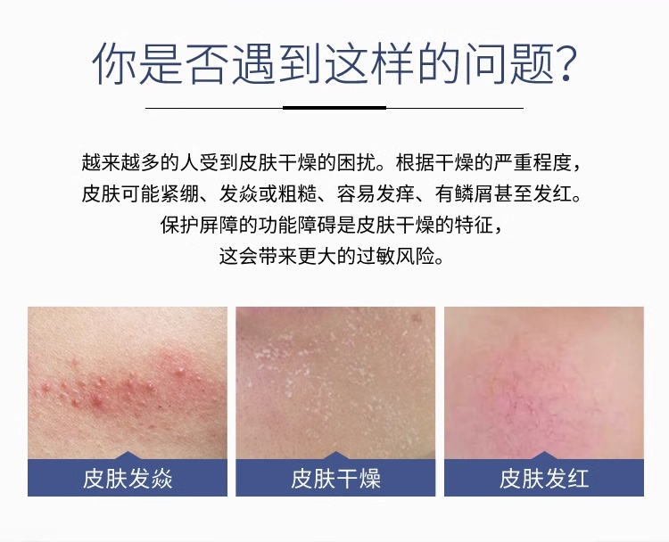 商品Eucerin|优色林 5%尿素干皮保湿润肤身体乳液 250-400ml 抗干燥滋润修复,价格¥180,第6张图片详细描述
