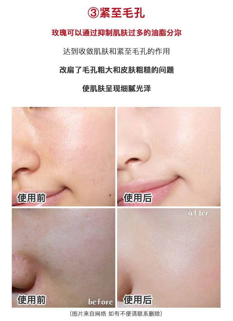 商品[国内直发] MEDIPEEL|韩国MEDIPEEL美蒂菲玫瑰安瓶面部精华补水保湿美白舒缓镇定100ml,价格¥79,第7张图片详细描述