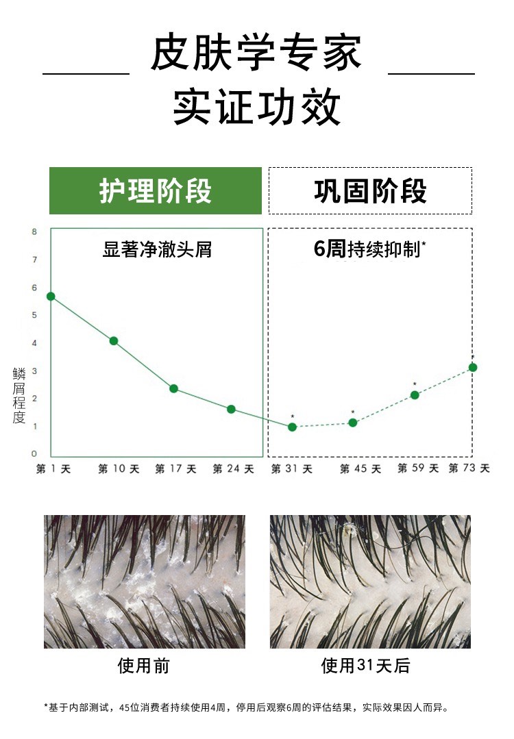 商品Vichy|Vichy薇姿DERCOS绿标男女发水200ml-390ml 去屑控油止痒,价格¥142,第5张图片详细描述