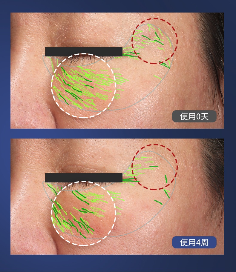商品[国内直发] YA-MAN|雅萌ACE Eye眼部射频美容仪提拉眼周美眼仪,价格¥2529,第13张图片详细描述