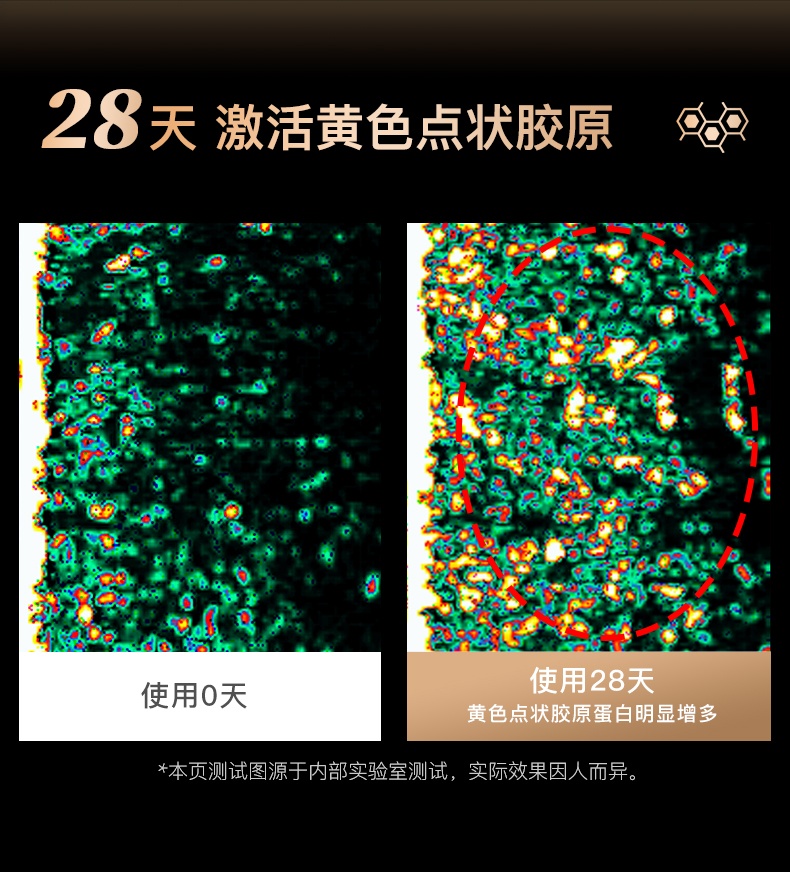 商品[国内直发] YA-MAN|雅萌YAMAN美容仪 ACE五代黄金五环射频仪 提拉紧致抗衰抗皱纹正品,价格¥4563,第20张图片详细描述