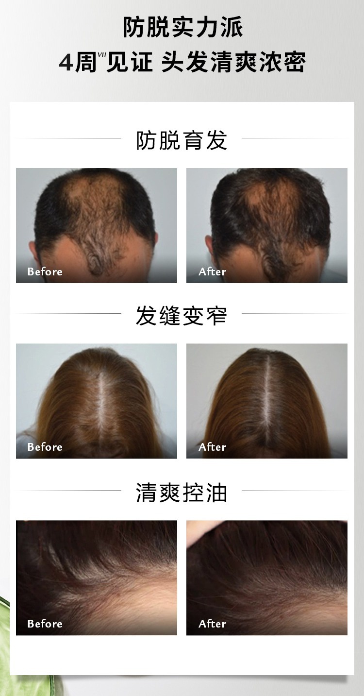 商品René Furterer|馥绿德雅洗护套装 小白珠洗发水250ml+三相防脱发安瓶精华44ml 固发育发,价格¥487,第2张图片详细描述