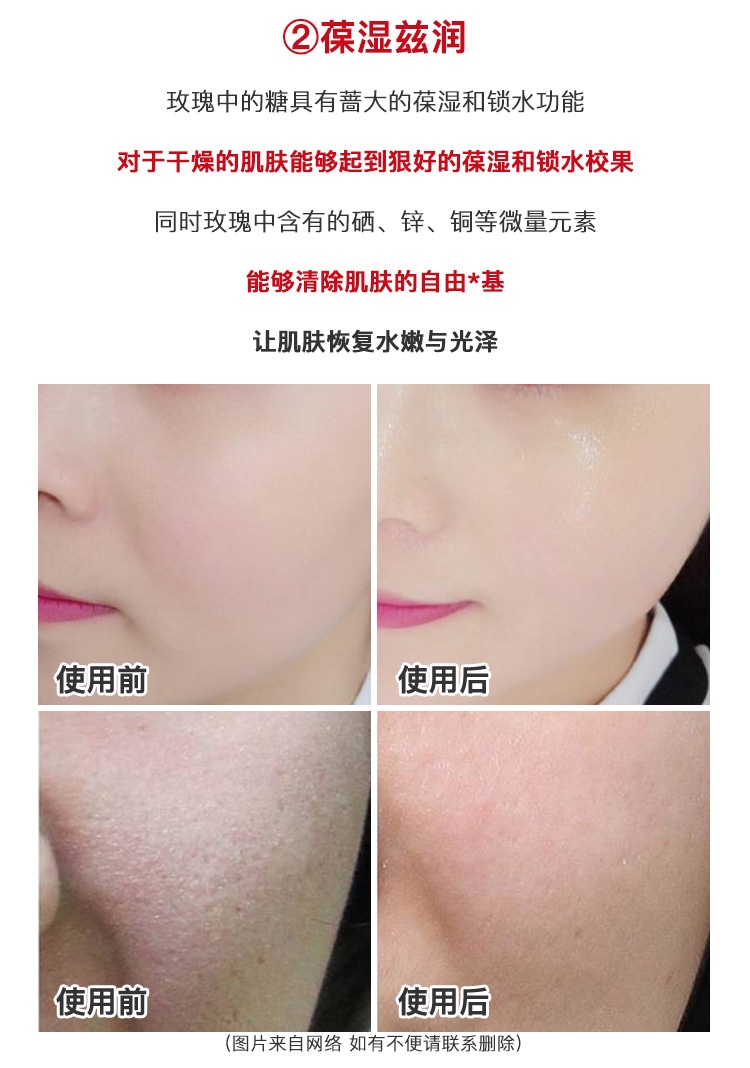 商品[国内直发] MEDIPEEL|韩国MEDIPEEL美蒂菲玫瑰安瓶面部精华补水保湿美白舒缓镇定100ml,价格¥79,第8张图片详细描述