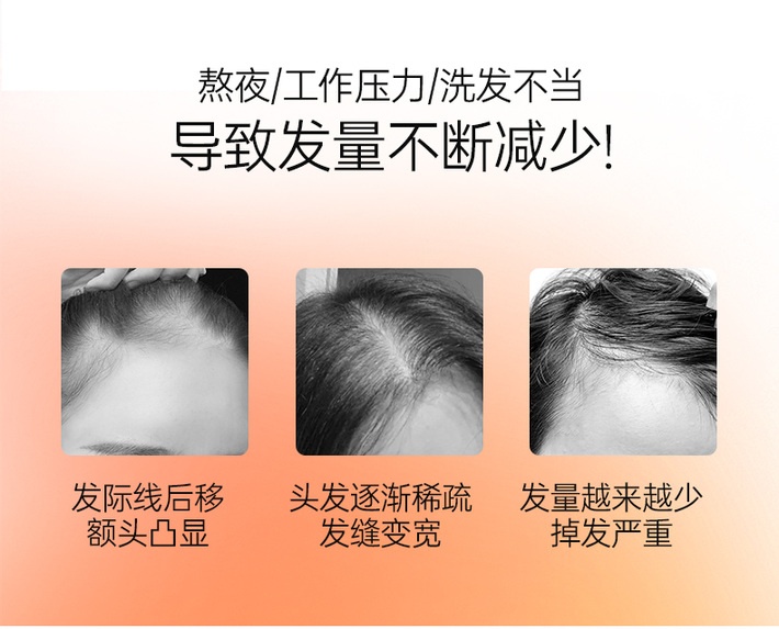 商品[国内直发] XLSSOSOLABO|【2盒装】日本水溶性硅元素养护生发增发饮15ml*30条/盒,价格¥736,第2张图片详细描述