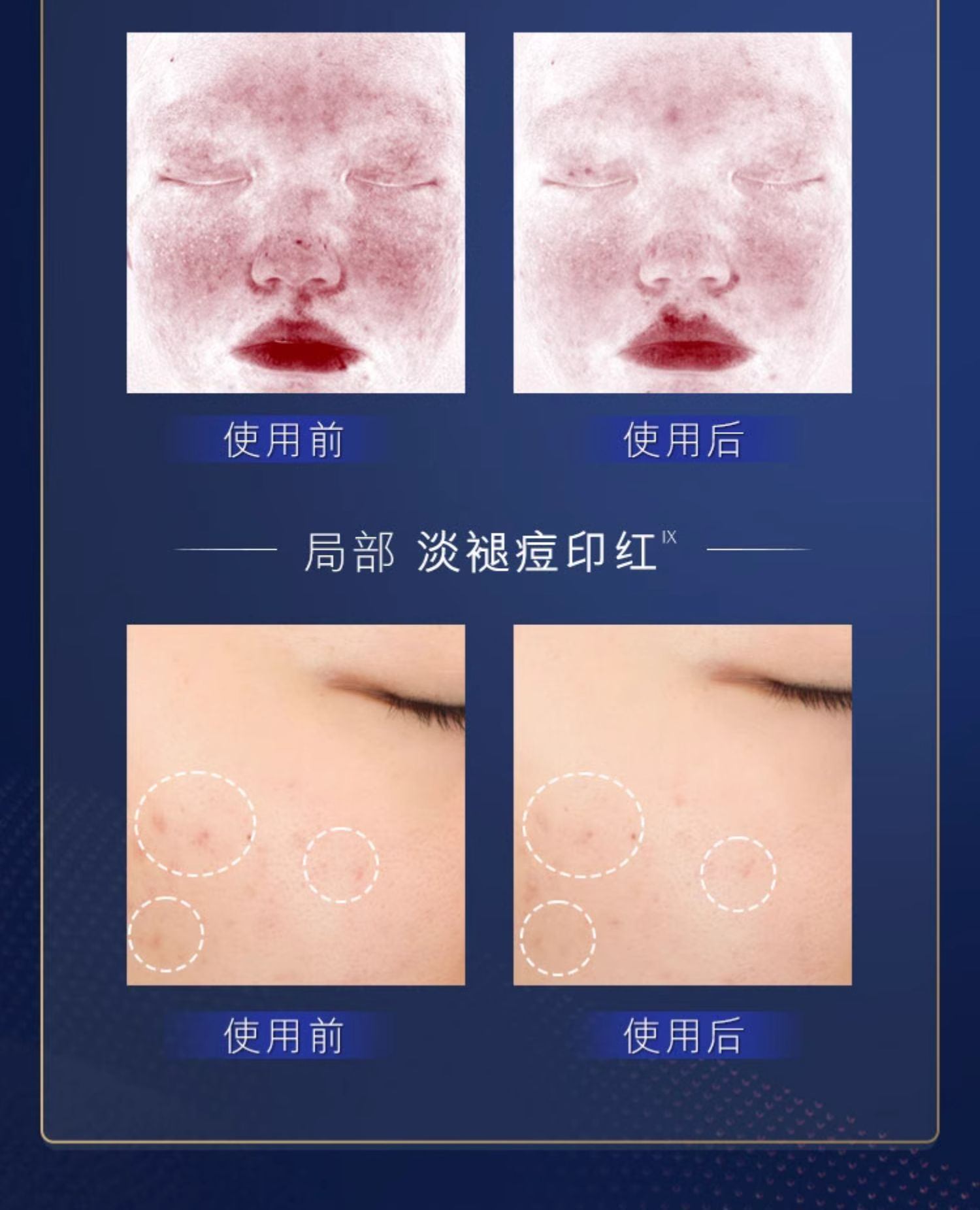 商品Estée Lauder|Estee Lauder 雅诗兰黛 SOS闪修精华 20ml 舒缓褪红修护敏感肌紧致,价格¥402,第12张图片详细描述