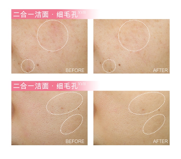 商品Estée Lauder|雅诗兰黛 红石榴泡沫洁面乳洗面奶 125ml 一支双用 清洁面膜抗氧排浊 ,价格¥245,第9张图片详细描述