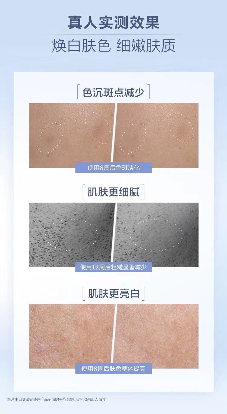 商品[国内直发] Lancôme|兰蔻    净澈焕肤淡斑精华极光淡斑精华30ml淡化色斑 焕亮肌肤,价格¥733,第6张图片详细描述