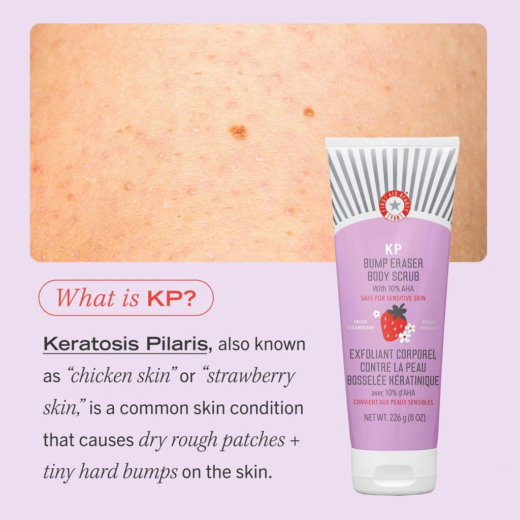 First Aid Beauty KP Bump Eraser Body Scrub with 10% AHA - Body Exfoliant for Keratosis Pilaris 56.7g 商品